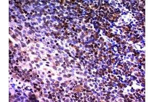 Formalin-fixed, paraffin-embedded human tonsil stained with NuMA antibody (A73-B/D12) (NUMA1 抗体)