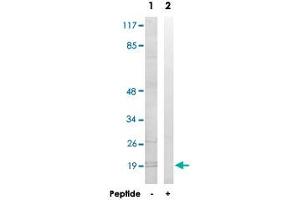 Western blot analysis of extracts from K-562 cells, using MRPL51 polyclonal antibody . (MRPL51 抗体)