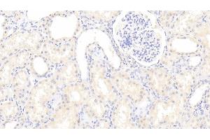 Immunohistochemistry (IHC) image for anti-Glutathione S-Transferase alpha 4 (GSTA4) (AA 3-222) antibody (ABIN7432334)