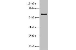 Western blot All lanes: KHDC4 antibody at 5 μg/mL + Mouse liver tissue Secondary Goat polyclonal to rabbit IgG at 1/10000 dilution Predicted band size: 65, 60, 41, 25 kDa Observed band size: 65 kDa (UPF0469 Protein KIAA0907 (KHDC4) (AA 1-241) 抗体)