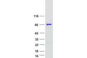Western Blotting (WB) image for Fat Mass and Obesity-Associated (FTO) protein (Myc-DYKDDDDK Tag) (ABIN2721440)