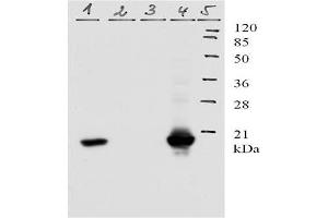 Picture: Western-Blot analysis of HPV-11 E7 protein. (Human Papilloma Virus 11 E7 (HPV-11 E7) (AA 1-35) 抗体)