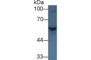 Western blot analysis of Rat Serum, using Rat SHH Antibody (1 µg/ml) and HRP-conjugated Goat Anti-Rabbit antibody ( (Sonic Hedgehog 抗体  (AA 237-399))