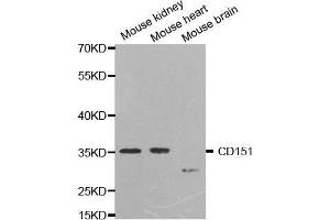 Western blot analysis of extracts of various cell lines, using CD151 antibody. (CD151 抗体  (AA 113-221))