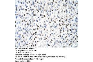 Immunohistochemistry (IHC) image for anti-Musashi Homolog 2 (MSI2) (N-Term) antibody (ABIN2776629)