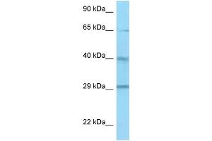 Western Blotting (WB) image for anti-Complement Factor H-Related 1 (CFHR1) (C-Term) antibody (ABIN2789086) (CFHR1 抗体  (C-Term))