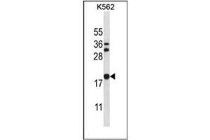 Western blot analysis of Stathmin-3 / STMN3 Antibody (C-term) in K562 cell line lysates (35ug/lane). (Stathmin 3 抗体  (C-Term))