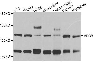 Western blot analysis of extracts of various cell lines, using APOB antibody. (APOB 抗体)