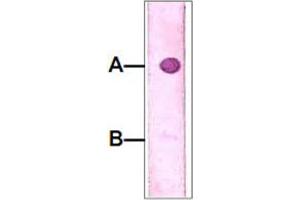 Dot Blot : 1 ug peptide was blot onto NC membrane. (IRAK4 抗体  (pThr345))