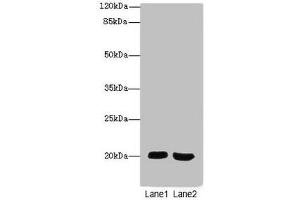 Western blot All lanes: MSRB2antibody at 2. (MSRB2 抗体  (AA 10-182))