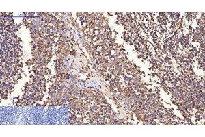 Immunohistochemistry of paraffin-embedded Human tonsil tissue using ERBB2 Monoclonal Antibody at dilution of 1:200. (ErbB2/Her2 抗体)