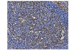 IHC analysis of PCBP1 using anti-PCBP1 antibody (ABIN7600127).