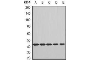 Western blot analysis of FHR3 expression in A549 (A), HepG2 (B), NIH3T3 (C), mouse liver (D), rat liver (E) whole cell lysates. (CFHR3 抗体)