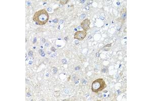 Immunohistochemistry of paraffin-embedded rat brain using NRG4 antibody (ABIN1873958) at dilution of 1:100 (40x lens). (Neuregulin 4 抗体)