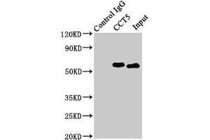 Immunoprecipitating CCT5 in Hela whole cell lysate Lane 1: Rabbit control IgG (1 μg) instead of ABIN7171417 in Hela whole cell lysate. (CCT5 抗体  (AA 1-270))
