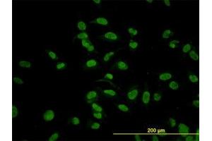 Image no. 6 for anti-Cytidine Monophosphate N-Acetylneuraminic Acid Synthetase (CMAS) (AA 164-264) antibody (ABIN466224) (CMAS 抗体  (AA 164-264))