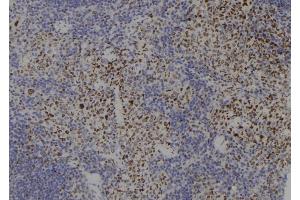 ABIN6265185 and ABIN6277766 at 1/100 staining Mouse spleen tissue by IHC-P. (SMC3 抗体  (C-Term))
