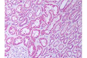 Immunohistochemistry (IHC) image for anti-Tumor Necrosis Factor Receptor Superfamily, Member 1B (TNFRSF1B) antibody (ABIN1104727)