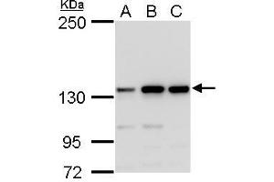 WB Image MSH3 antibody detects MSH3 protein by western blot analysis. (MSH3 抗体  (N-Term))