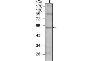 Western Blot showing TBX5 antibody used against HepG2 cell lysate (1). (T-Box 5 抗体)