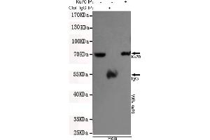 Immunoprecipitation analysis of Hela cell lysates using Ku70 mouse mAb. (XRCC6 抗体)