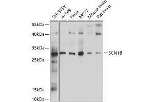 Western blot analysis of extracts of various cell lines, using SCN1B antibody (ABIN6132634, ABIN6147433, ABIN6147434 and ABIN6214194) at 1:1000 dilution. (SCN1B 抗体  (AA 19-160))