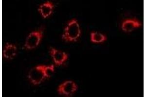 Immunofluorescent analysis of S100-A11 staining in SKOV3 cells. (S100A11 抗体)