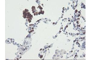 Image no. 3 for anti-RNA Binding Protein with Multiple Splicing (RBPMS) antibody (ABIN1500642)