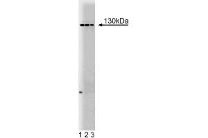 Western blot analysis of M-Cadherin on mouse neonate lysate. (CDH15 抗体  (AA 253-366))