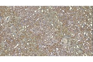 Immunohistochemistry (IHC) image for anti-Roundabout, Axon Guidance Receptor, Homolog 1 (ROBO1) (Internal Region) antibody (ABIN185537)