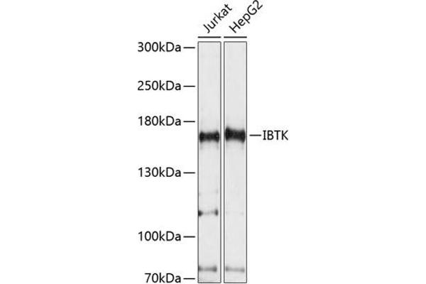 IBTK anticorps  (AA 900-1200)