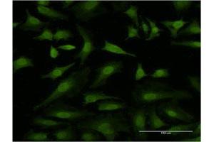 Immunofluorescence (IF) image for anti-Hexamethylene Bis-Acetamide Inducible 1 (HEXIM1) (AA 1-359) antibody (ABIN524038)