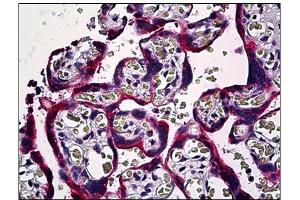 Immunohistochemistry (IHC) image for anti-SMAD, Mothers Against DPP Homolog 3 (SMAD3) antibody (ABIN781907)