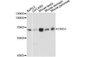 Western blot analysis of extracts of various cell lines, using VSIG1 antibody. (VSIG1 抗体)