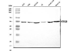 Western blot analysis of 5HT1B/HTR1B using anti-5HT1B/HTR1B antibody (ABIN7601425).