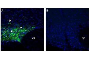 Expression of MAGT1 in rat supra-optic nucleus. (MAGT1 抗体  (Extracellular, N-Term))
