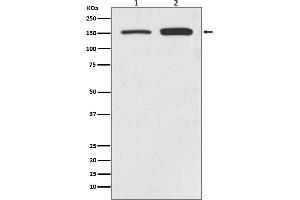 Western blot analysis of SMC1 expression in (1) HeLa cell lysate, (2) Jurkat cell lysate.