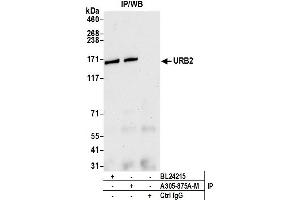 Immunoprecipitation (IP) image for anti-URB2 Ribosome Biogenesis 2 Homolog (URB2) (AA 1474-1524) antibody (ABIN7449667) (URB2 抗体  (AA 1474-1524))