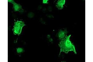 Image no. 3 for anti-Low Density Lipoprotein Receptor Adaptor Protein 1 (LDLRAP1) antibody (ABIN1496689) (LDLRAP1 抗体)