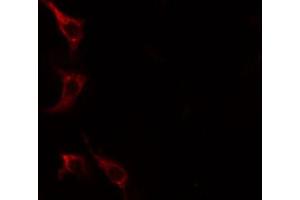 ABIN6267612 staining HeLa cells by IF/ICC. (LIPE 抗体  (pSer552))