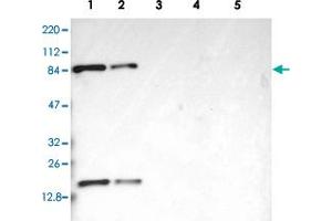 Western blot analysis of Lane 1: RT-4, Lane 2: U-251 MG, Lane 3: Human Plasma, Lane 4: Liver, Lane 5: Tonsil with CD2AP polyclonal antibody  at 1:250-1:500 dilution. (CD2AP 抗体)