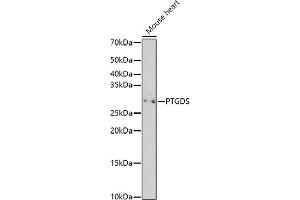 Western blot analysis of extracts of Mouse heart, using PTGDS antibody (ABIN6128311, ABIN6146397, ABIN6146398 and ABIN6219023) at 1:500 dilution. (PTGDS 抗体  (AA 23-190))