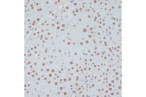 Immunohistochemistry of paraffin-embedded rat liver using Phospho-p53-S33 antibody (ABIN6135330, ABIN6136276, ABIN6136277 and ABIN6225656) at dilution of 1:100 (40x lens). (p53 抗体  (pSer33))