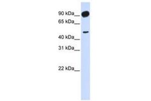 Image no. 1 for anti-Adducin 2 (Beta) (ADD2) (AA 648-697) antibody (ABIN6741133) (ADD2 抗体  (AA 648-697))