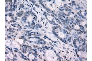 Image no. 8 for anti-Interferon Regulatory Factor 3 (IRF3) antibody (ABIN1498899) (IRF3 抗体)