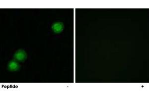 Immunofluorescence analysis of MCF-7 cells, using PKIB polyclonal antibody . (PKIB 抗体)