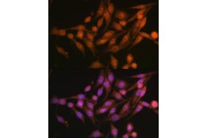 Immunofluorescence analysis of HeLa cells using PSMD13 Polyclonal Antibody (ABIN6132189, ABIN6146337, ABIN6146339 and ABIN6222707) at dilution of 1:100 (40x lens). (PSMD13 抗体  (AA 1-250))