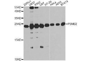 Western blot analysis of extracts of various cell lines, using PSMB2 antibody. (PSMB2 抗体  (AA 1-201))
