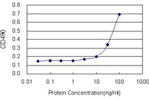 CTH (Human) Matched Antibody Pair