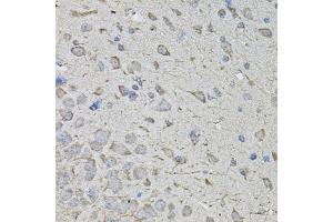 Immunohistochemistry of paraffin-embedded mouse brain using CDK10 antibody. (CDK10 抗体)